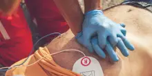 La chiamano "sindrome di Lazzaro". Uomo di 78 anni muore, ma dopo mezz'ora il cuore riprende a battere