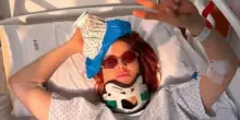 Musica, Noemi cade dal palco, 30 giorni di stop: &ldquo;Qualche acciacco&rdquo;