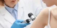 Sidemast: negare che raggi uv causino i melanomi &egrave; mistificazione