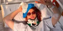 Noemi dopo la caduta dal palco in Abruzzo: 'Ho la testa dura'
