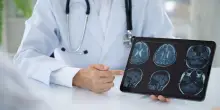 Parkinson, Stocchi (San Raffaele): Un paziente su 4 ha meno di 50 anni