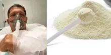 Allergia alla caseina e shock anafilattico: sintomi e cosa fare