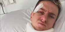 Pogacar, la foto dall'ospedale dopo la caduta