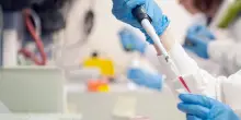 Melanoma, a 5 anni vivo il 92% trattato con vaccino personalizzato