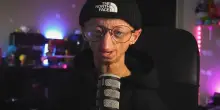 &Egrave; morto Michiel Vandeweert, content creator belga malato di progeria