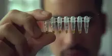 Doping, Epo: cos'&egrave; l'eritropoietina e i suoi effetti nello sport