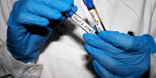 Hantavirus, chi sono e come stanno i residenti in Italia in quarantena