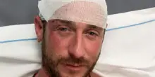 Pestato perch&eacute; gay in spiaggia a Olbia, la denuncia di un 39enne