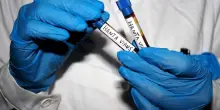 Hantavirus in Italia, il piano delle regioni per contenere contagi