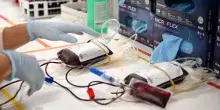 Allarme carenza di sangue in Italia, manca soprattutto il gruppo 0+