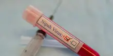 Virus Nipah in India, uno studio italiano utilizza l'IA