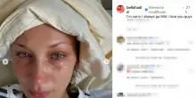 Bella Hadid in ospedale, forse per malattia di Lyme: le foto su IG