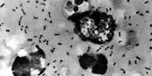Russia, donna muore di peste polmonare: lavorava in un laboratorio