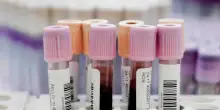 Giornata dei donatori di sangue: in Italia dati in leggero calo
