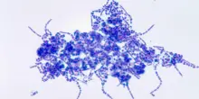 Malattia della pioggia, aumentano i casi in Europa: cos'&egrave; e sintomi