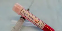 Virus Nipah in India, gli esperti: 'No allarmismi'. Di cosa si tratta