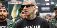 Travis Barker operato dopo la diagnosi di sindrome del tunnel cubitale