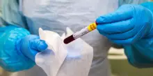 Ebola, primo caso di contagio accertato in Francia: &egrave; un medico