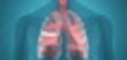 In arrivo in Italia farmaco biologico mirato per gestire la Bpco