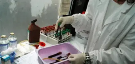 Epatite a Napoli, sono 53 i contagiati. La Regione aumenta l'offerta di vaccini