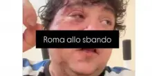 San Lorenzo, il rapper pestato dal branco e quelle sviolinate sulla (finta) integrazione