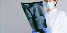 Il Covid ha cambiato percezione malattie respiratorie, nuova attenzione a rischi