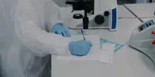 Tumori germinali dell'ovaio, identificati i fattori per la prognosi