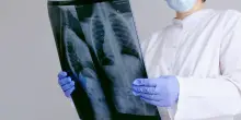 Tumori rari, i sarcomi richiedono diagnosi tempestive e alta specializzazione
