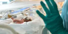 Screening neonatale arma per la diagnosi precoce, ma il rischio &egrave; la sovradiagnosi