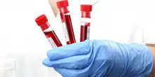 Test del sangue low cost che rileva tumori e malattie dal Dna circolante