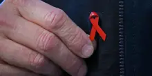 Hiv &lsquo;sparito&rsquo; dopo il trapianto di staminali, il paziente di Oslo