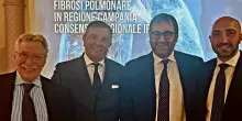 Fibrosi polmonare verso un nuovo modello di cura: il progetto