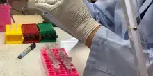 Hantavirus nuovo Covid? L&rsquo;analisi dell&rsquo;epidemiologo Ciccozzi