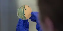 Shigella, cos&rsquo;&egrave; il batterio che ha colpito i due cooperanti italiani