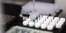 Tumore al pancreas, la promessa della pillola che raddoppia la sopravvivenza