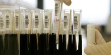Atrofia muscolare spinale, ok dall&rsquo;Ue a terapia genica sopra i due anni