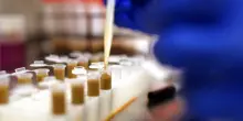 Batterio killer in un asilo di Tropea, che cos&rsquo;&egrave; Clostridium difficile