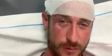 Sardegna, picchiato in spiaggia perch&eacute; gay: aggredito da 30 persone