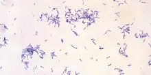 Difterite e vaccini: i numeri in Italia e la differenza tra positivit&agrave; e malattia