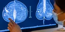 Ottobre Rosa, il programma di prevenzione di Artemisia Lab