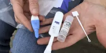 Hiv, nel Lazio 361 nuove diagnosi nel 2024: +3,7% in un anno
