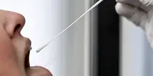 Mal di gola in agguato: non &egrave; ancora influenza, occhio a placche e farmaci