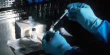 Neva Sgr investe in Nouscom per sviluppo immunoterapie contro il cancro