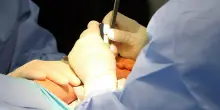 Sfida alle 24 ore: la rivoluzione che sta cambiando il recupero dopo la ricostruzione mammaria