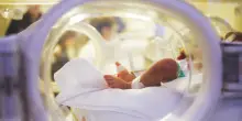 Neonata salvata con la colla acrilica, operata con una tecnica innovativa al Regina Margherita di Torino