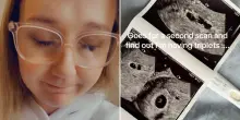 “Ero incinta di tre gemelli, ma ne ho partorito solo uno perché mio figlio ha mangiato i suoi fratelli mentre era nel mio grembo”: la storia incredibile su TikTok