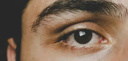&ldquo;Un parassita sta mangiando il mio occhio, &egrave; qualcosa di terrificante&rdquo;: pensava fosse una semplice irritazione, ora rischia di perdere la vista. La storia di Matt Flack