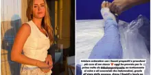 Valentina Ferragni si fa &ldquo;ingessare&rdquo; le gambe: &ldquo;Drena i liquidi e lascia un senso di leggerezza estrema&rdquo;. Cos&rsquo;&egrave; e come funziona la calcoterapia