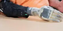 La mano bionica e il senso del tatto, negli Usa sperimentazione su per 12 amputati