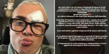 “Sto bene a parte qualche punto in fronte”: l’influencer Mariano Prank riappare sui social dopo l’incidente stradale